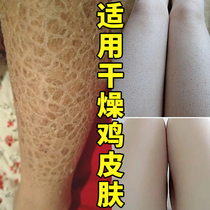 Body milk whole body hydrating moisturizing skin dry peeling body legs up chicken skin moisturizing autumn and winter fragrance body