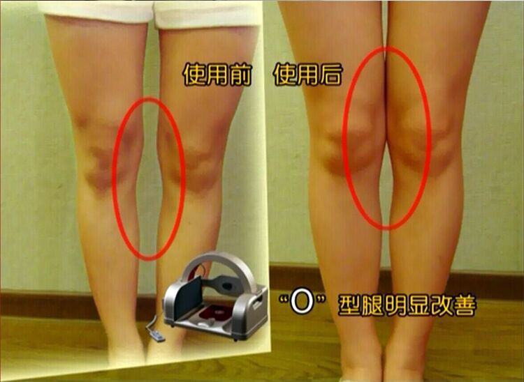 厂家直销骨盆修复仪矫正仪产后修复仪提臀卵巢保养收缩提臀仪器