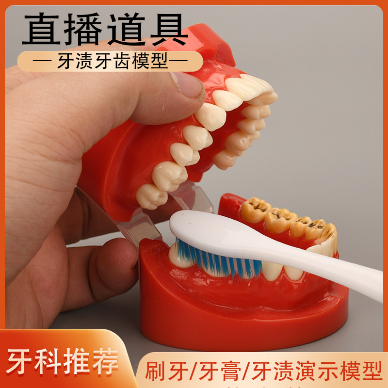 牙齿模型 仿真假一半蛀牙渍道具 刷牙线科直播视频展示坏牙垢模具