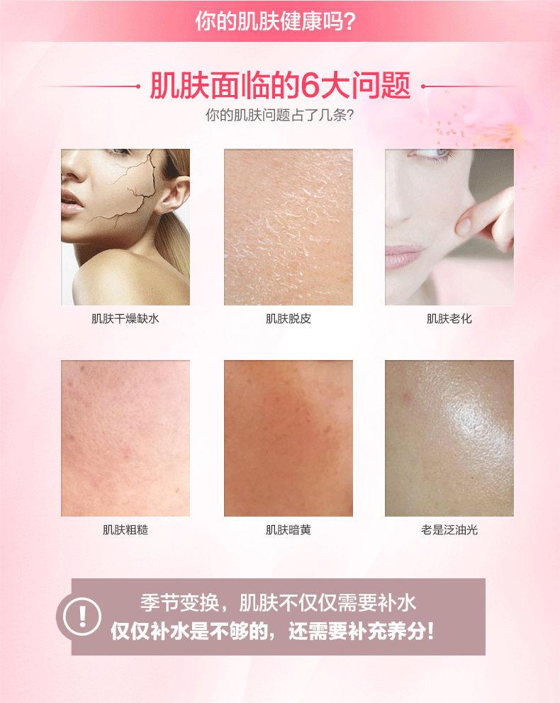 Miracle Advanced ma thuật làm đẹp mật ong tại chỗ màu vàng sẫm dưỡng ẩm kem dưỡng ẩm trong nước sản phẩm chăm sóc da cũ thẻ nữ - Kem dưỡng da kem dưỡng ẩm da dầu
