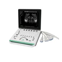 SS - 7 Medical Portable B Superman B Superman B Superplane Wireless Probe B SuperBeast with black and white notebook B Ultra