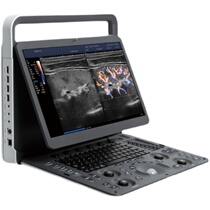 Open E2 portable B Ultra Color Ultrasound Diagnostic System Color Notebook B Ultra Color Deposit