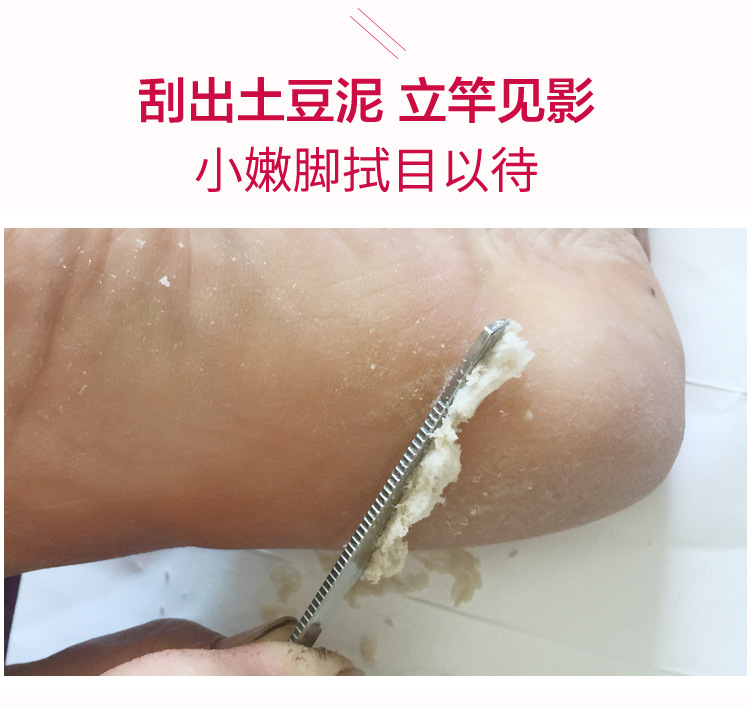 Mua 1 tặng 3 đến lòng bàn chân sừng móng chân mài đá care chăm sóc chân cũ cho da chết mềm chân e kho báu thuốc nứt gót chân