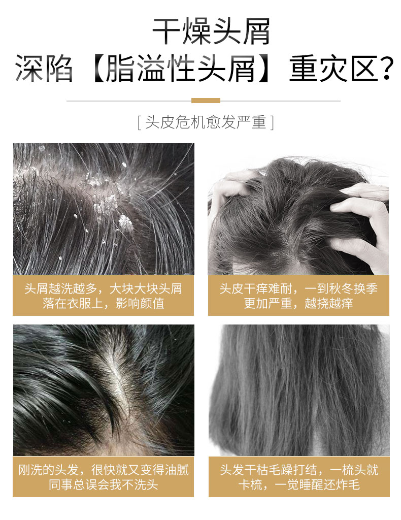 采乐 强劲去屑止痒洗发水 日本花王原料 400ml 图3