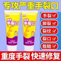 Hand crack hands and feet crack cream crack moisturizing men skirting women opening crack crack cream