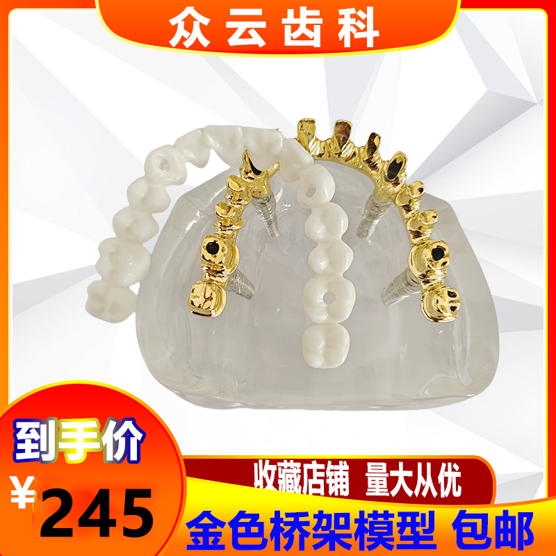 牙科种植体修复模型种植球钉帽结合半口综合病理种植与无牙颌模型
