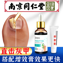 Nanjing Tongrentang Grey Nail Bacteriostatic Liquid Sofchia Decchia Plasters Ice Acetate Antimicrobial Daubing