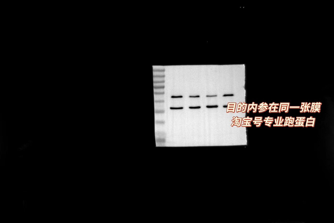 Westernblot条带，WB/wb条带，科研服务，趋势定做。