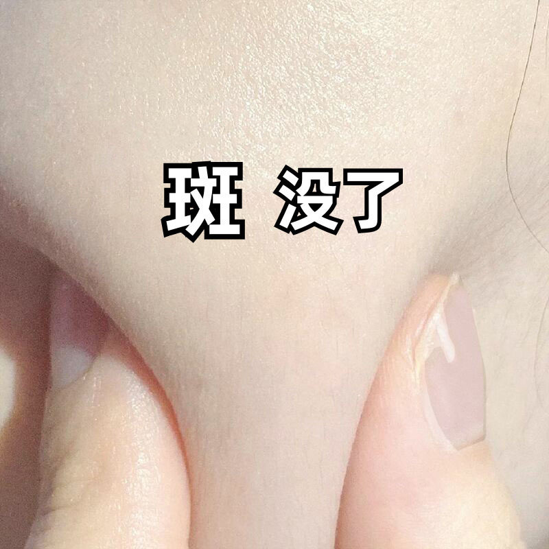 (Li Jiaqi Live recommended) Down the spot black spot on the face 158 three bottles one cycle