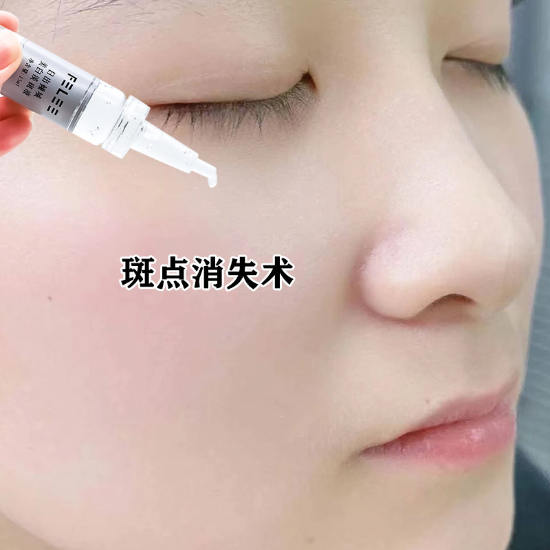 (Recommended for light spots) Lighten spots and black spots on the face 158 three bottles per cycle