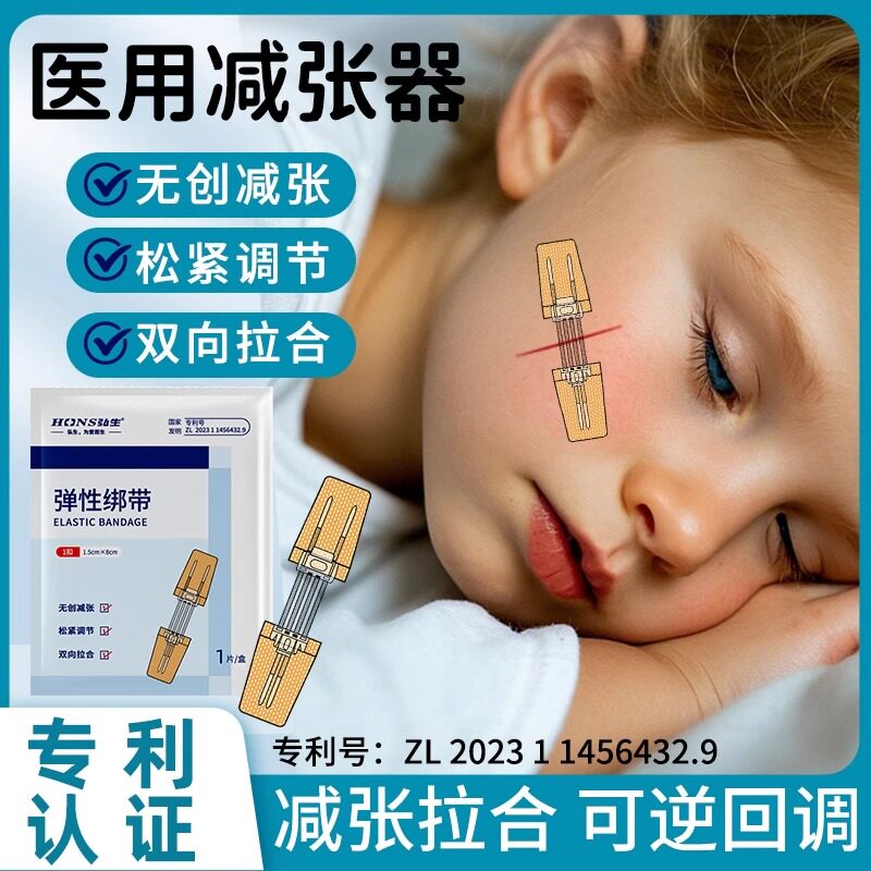 医用减张贴伤口拉链式创可贴儿童疤痕缝合器剖腹产术后皮肤免缝