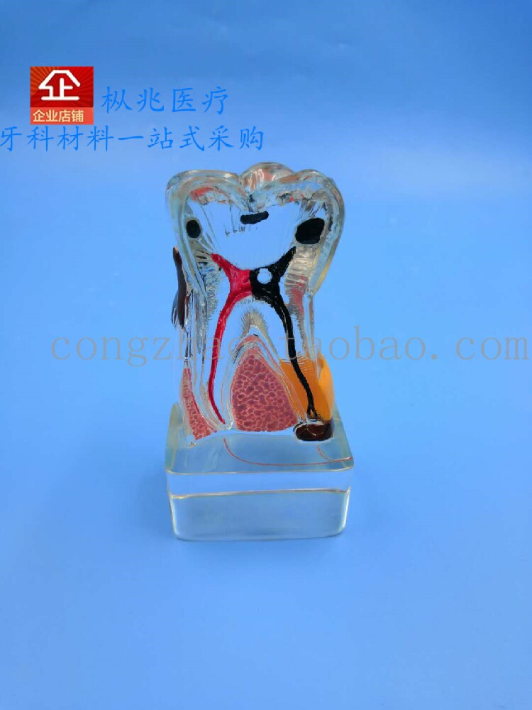 牙科口腔教学模型 四倍牙周病例模型