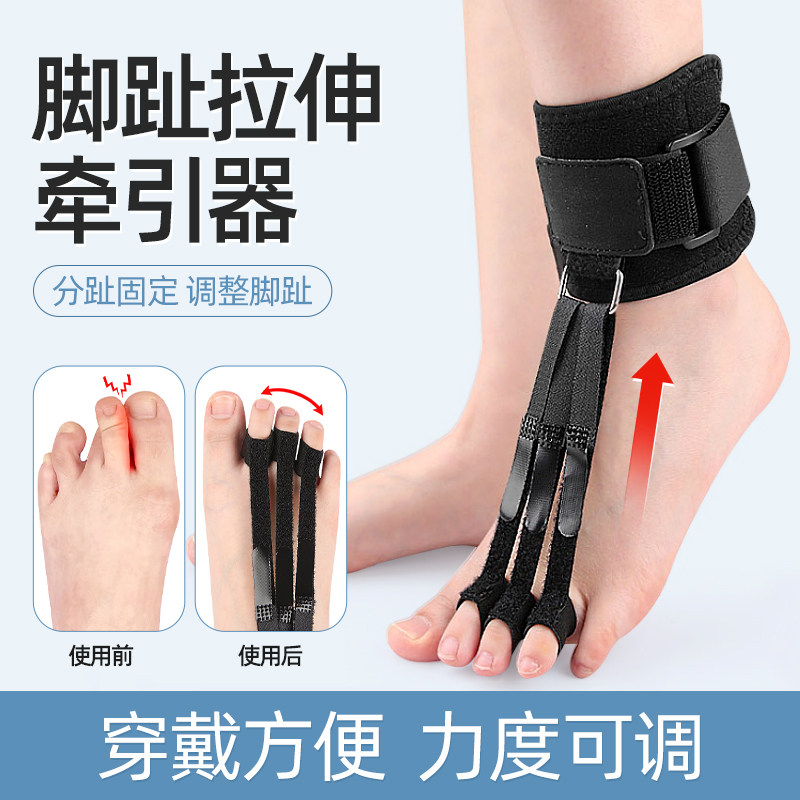 脚趾矫正器拉伸牵引器锤状趾分趾爪型弯曲重叠伸直纠正神器可穿鞋
