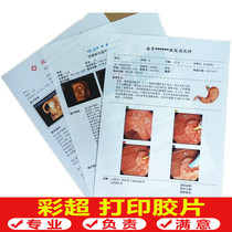 Hospital Colour B superfilm paper Porcelain White A4 Inkjet Pregnancy Ultrasound Examination Report Four Dimensional Medical Film Single Paper
