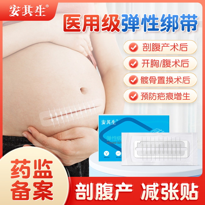 医用减张贴剖腹产术后伤口免缝合器胶带皮肤愈合防止增生疤痕贴