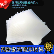 Medical film porcelain white inkjet film medical film A4 film gastroscopy B-ultrasound four-dimensional color ultrasound printing paper