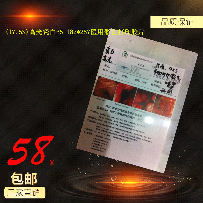 (17 5S) High-gloss porcelain white B5 182*257 medical color printing film B-ultrasound color ultrasound medical film
