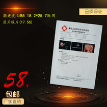 High-light ceramic white B5 18 2*25 7 Medical color printing film B Ultra color medical film(17 5S)