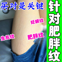 Remove pregnancy obesity scars caesarean section repair cream scar removal cream remove postpartum pregnancy growth and tighten the belly