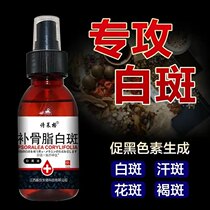 Go to white spot Sweat Spot Spray to repair non-covered white spot drug to promote melanin formation