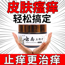 Official Full Body Itching Itching King Hands And Feet Itch Stop Itch Cream Guarantee Buy 2 Sending 1 Buy 3 sending 2