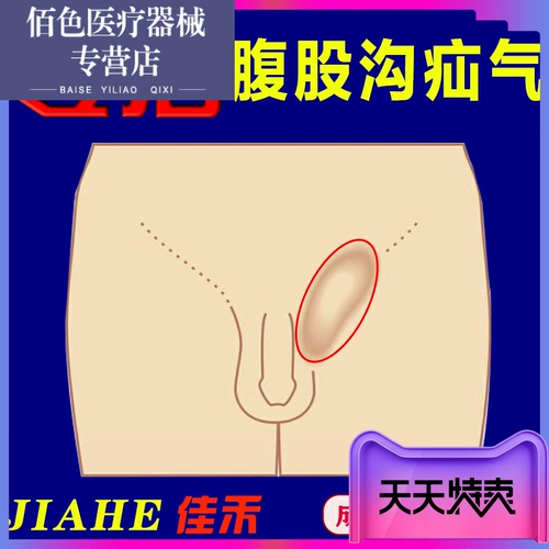 Суммарная детская и пожилая пожилая грыжа поясни