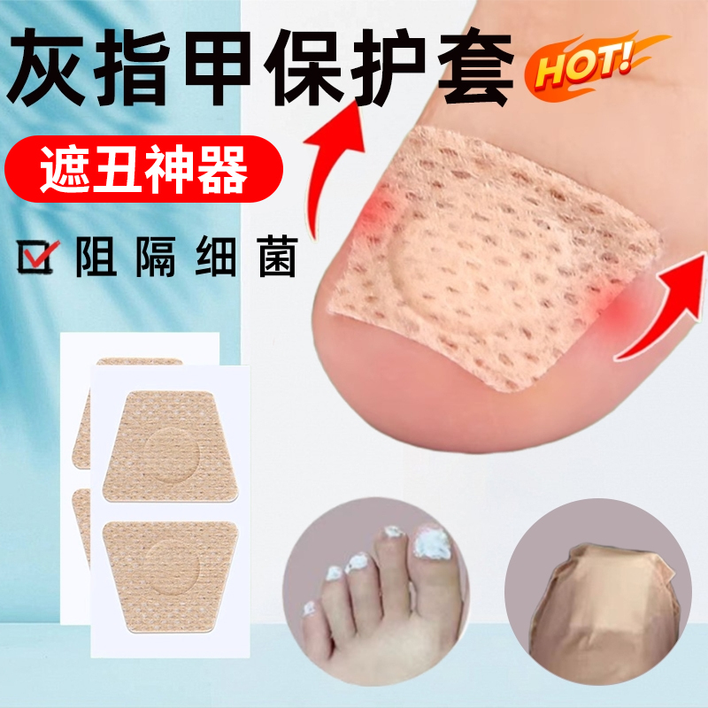 Nail Protection Cover, Waterproof, Anti-Scratch, Skin-Friendly, Breathable, for Applying Medication, Protecting Nail Groove Inflammation, Concealing Nail Damage, Adhesive Tape