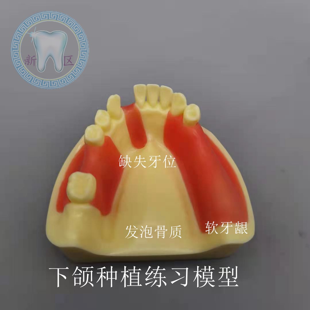 牙科 下颌种植练习模型 牙缺失仿真软牙龈 骨质发泡 口腔演示讲解