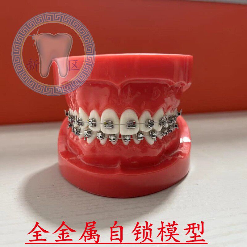 牙科 口腔金属自锁托槽对比模型 正畸金属托槽示范模型 包邮