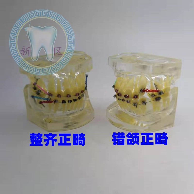牙科 错颌矫正展示模型扎丝托槽正畸 透明牙齿模型牙科教学模型