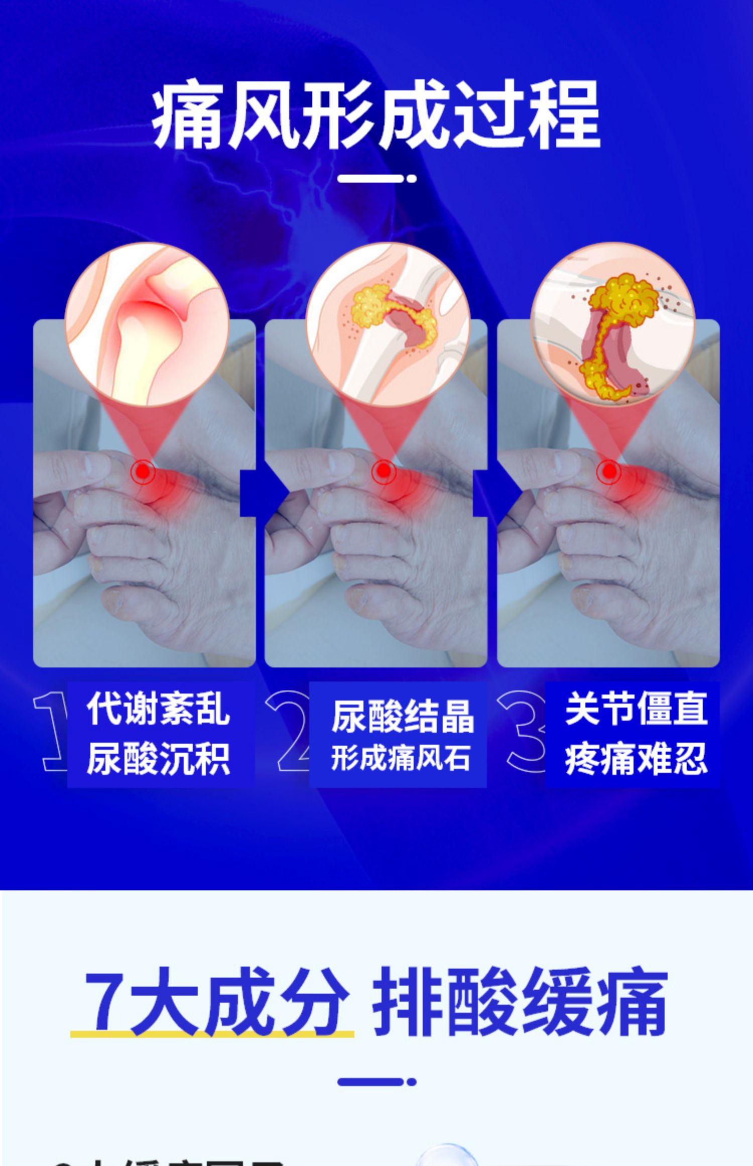 【拍2件】美柏莱尿酸高100粒酸黑樱桃片