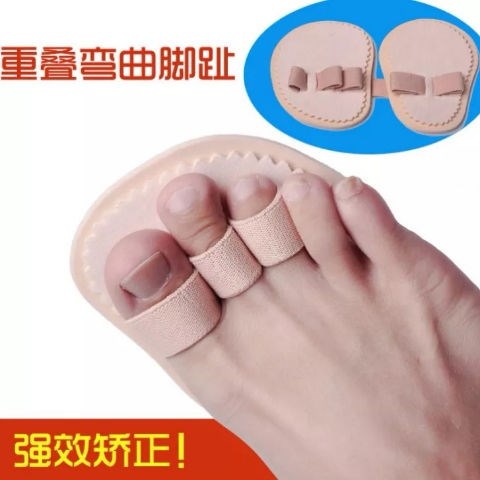 脚趾弯曲矫正器爪状趾锤状指纠正器变形趾重叠趾矫形器