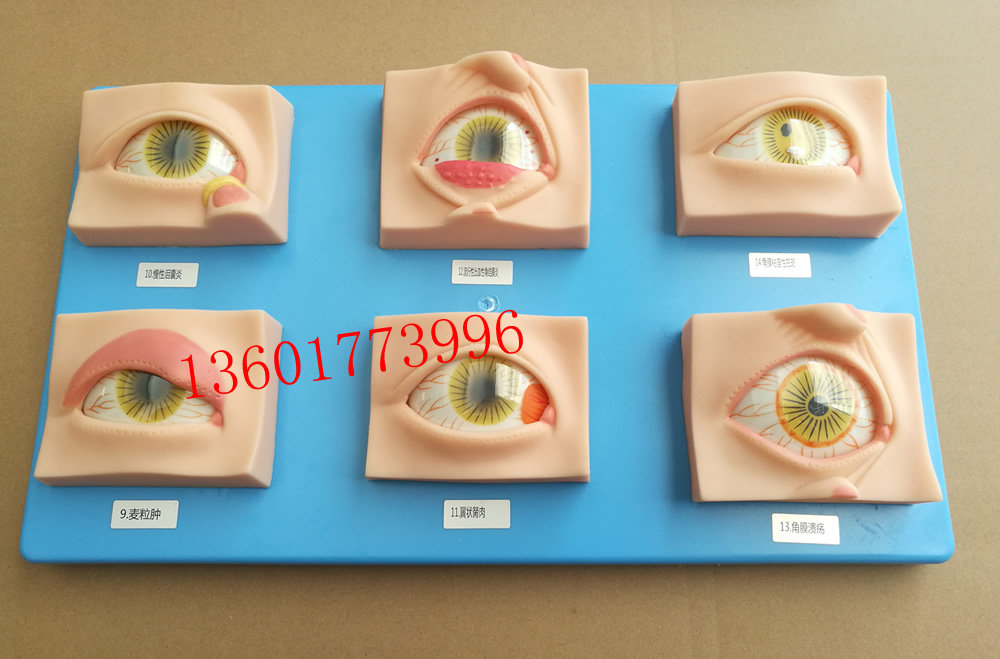 人体常见眼病模型常用眼科疾病模具眼病模型20种常见眼球病变模型