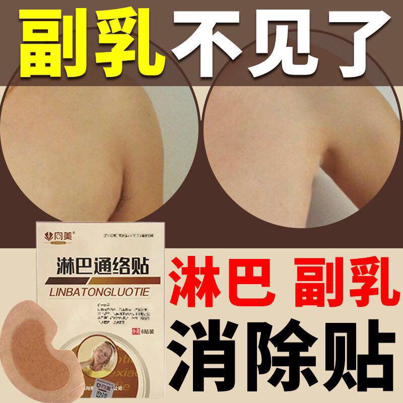 Go to the auxiliary milk artifact auxiliary milk paste neck dredging lymph node Sanjie paste edema large anti-inflammatory paste lymph node elimination paste