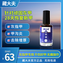 Tibetan doctor onychomycosis special removal thickened nail removal ointment phytothelin glacial acetic acid bacteriostatic solution
