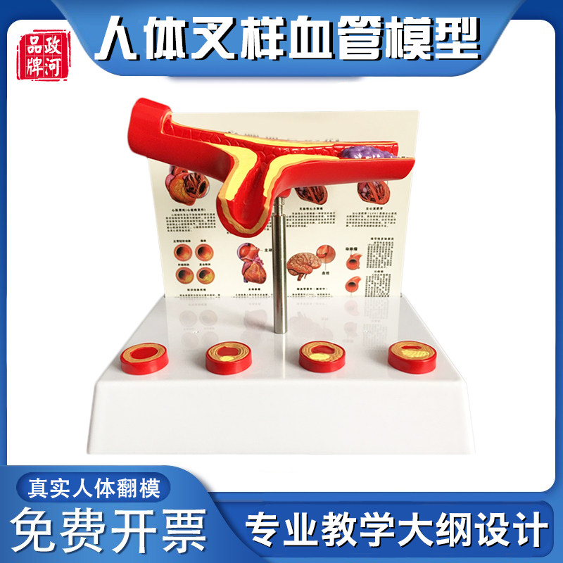 人体血管模型人体支脉粥样1硬化 心血管动脉1.硬化模型 血栓 模具