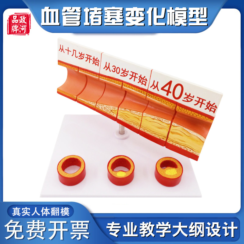 人体血管模型器官解剖结构层次模型动脉血管阻塞变化演示教学模具