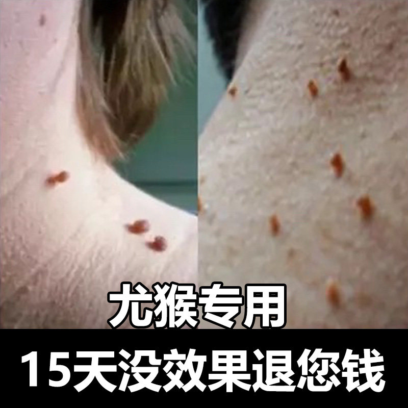 Fluorouracil ointment flat sharp selfie 5-fu5 % Buddha pentafluorouracil ointment cream 20 gr