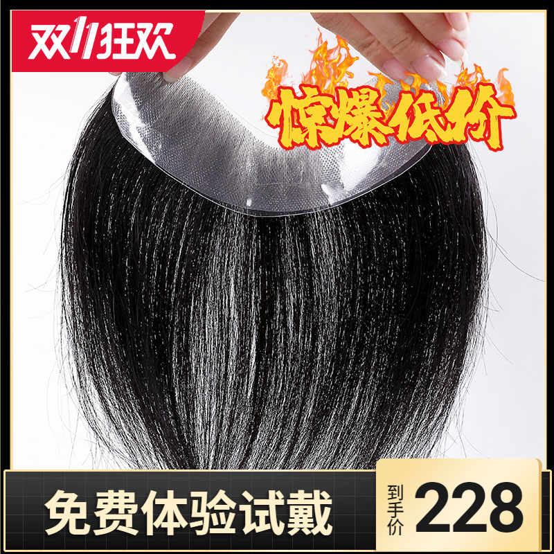 Male Hairline False Hair Patch Forehead Patch M Type Liu Hai Back Head High Forehead Hair Loss Real Hair Is Invisible