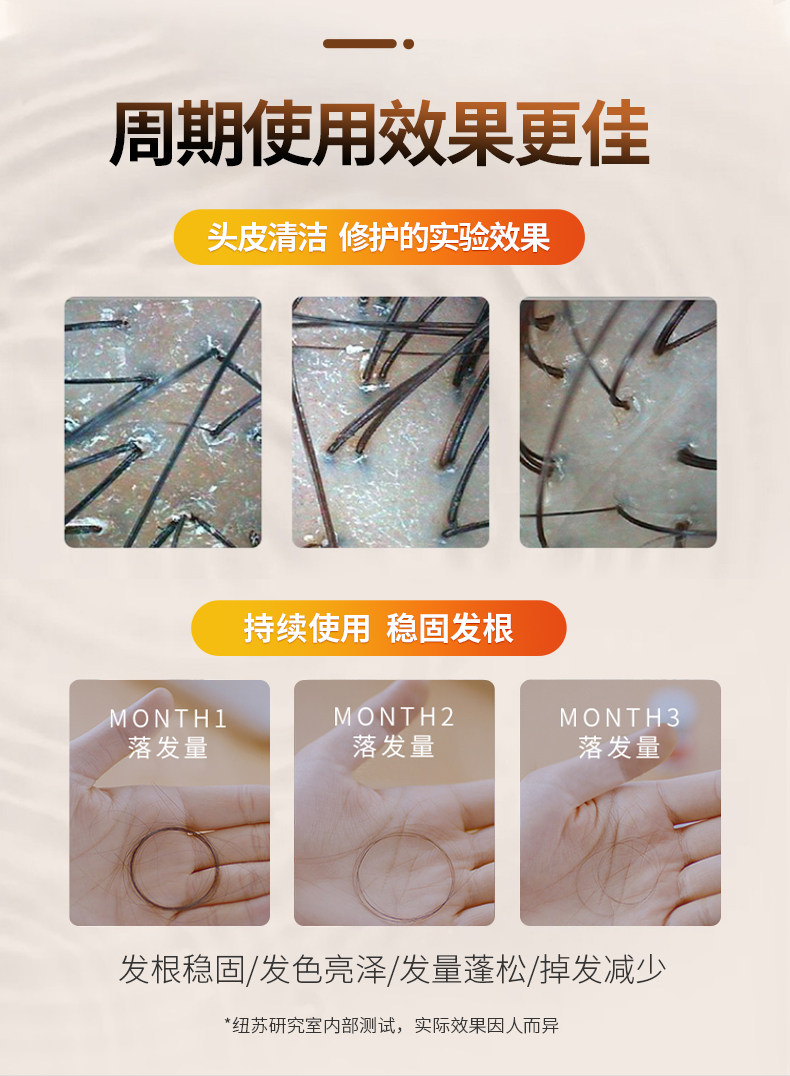 西班牙 Nuggela 金牌防脱发洗发水 250ml 图9