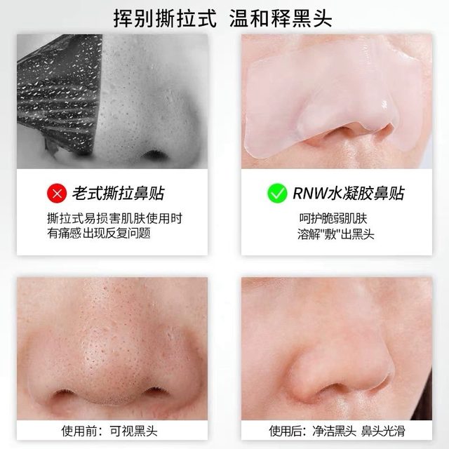 rnw blackhead removal nose patch official flagship store export liquid shrink patch pore ທໍາຄວາມສະອາດອ່ອນໂຍນຜູ້ຊາຍແລະແມ່ຍິງ strawberry ດັງ