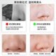 rnw blackhead removal nose patch official flagship store export liquid shrink patch pore cleaning gentle men and women strawberry nose