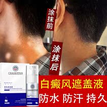 White Purpura Wind Cover Liquid Theorizer Face Waterproof Persistent Hand White Spotted Skin Color Covering Liquid Official Flawless Pen