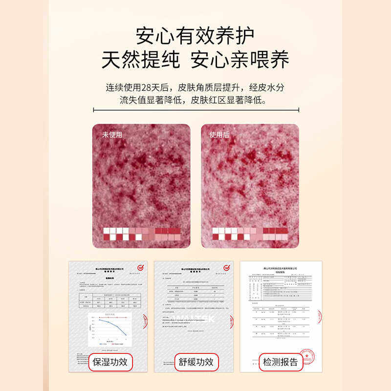 Yifumei Nipple Nipple, Breast, Mutton Fat Cream, Anti-Chapped Cream for Pregnant Women, Postpartum Repair Cream, Special for Lactation Periods