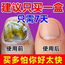 (Tong Ren Tang Hot Sale 100000) No guarantee no repair. A drop of it will painlessly remove bad potassium from your hands and toes without damaging the good potassium.