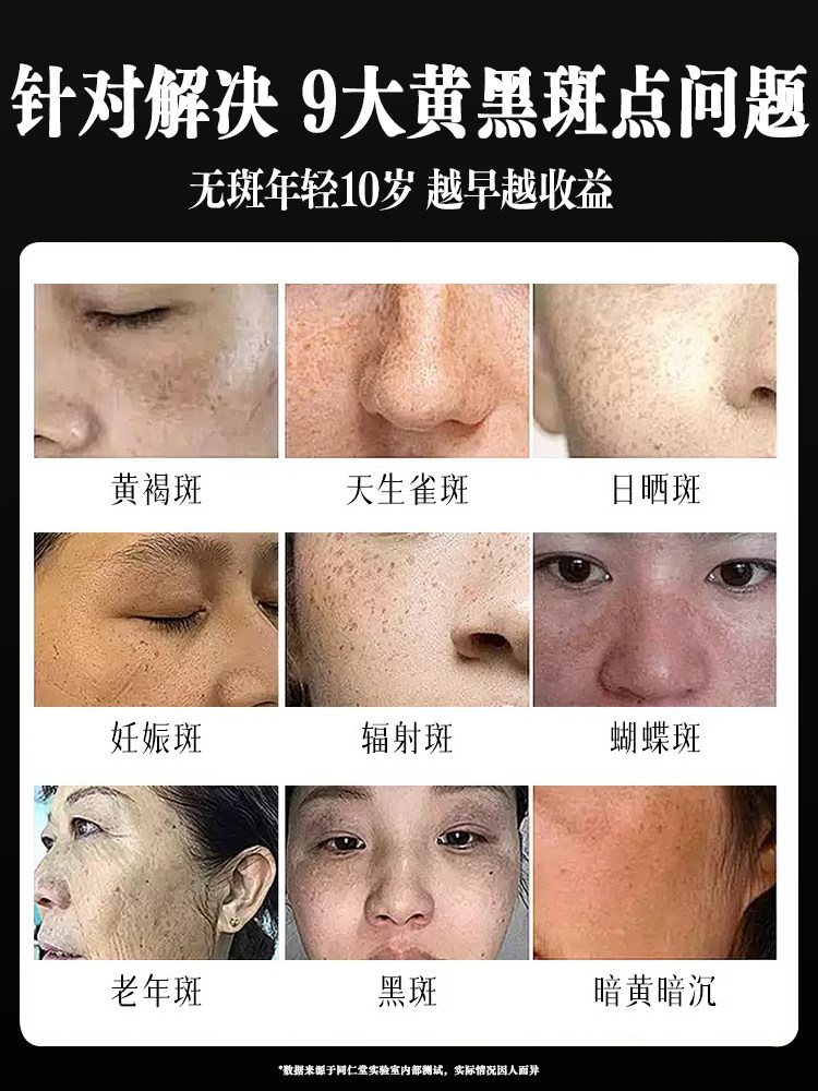 Black Bandage Whitening and Freckle Removal Cream, Niacinamide, Removes Chloasma, Age Spots, and Freckles, Special Morning and Night Cream, Official Authentic Product