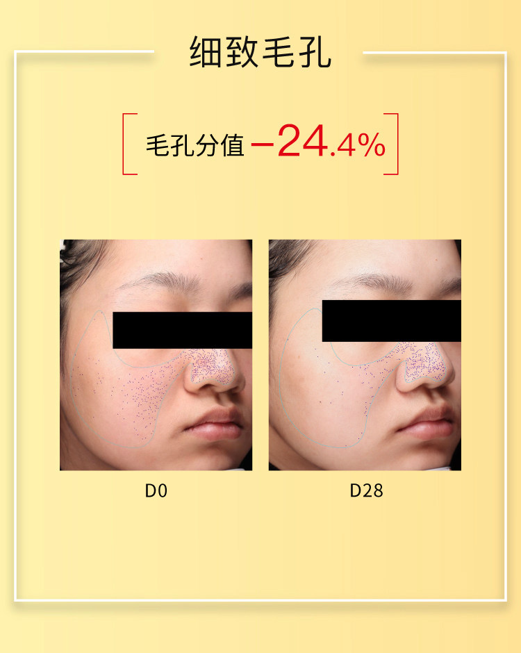 【香港直邮】 John Jeff 姜黄精华液30ml 敏皮专研抗氧|4%姜黄素+2%油橄榄 |褪红提亮双效 |控油不拔干 |熬夜暗沉救星