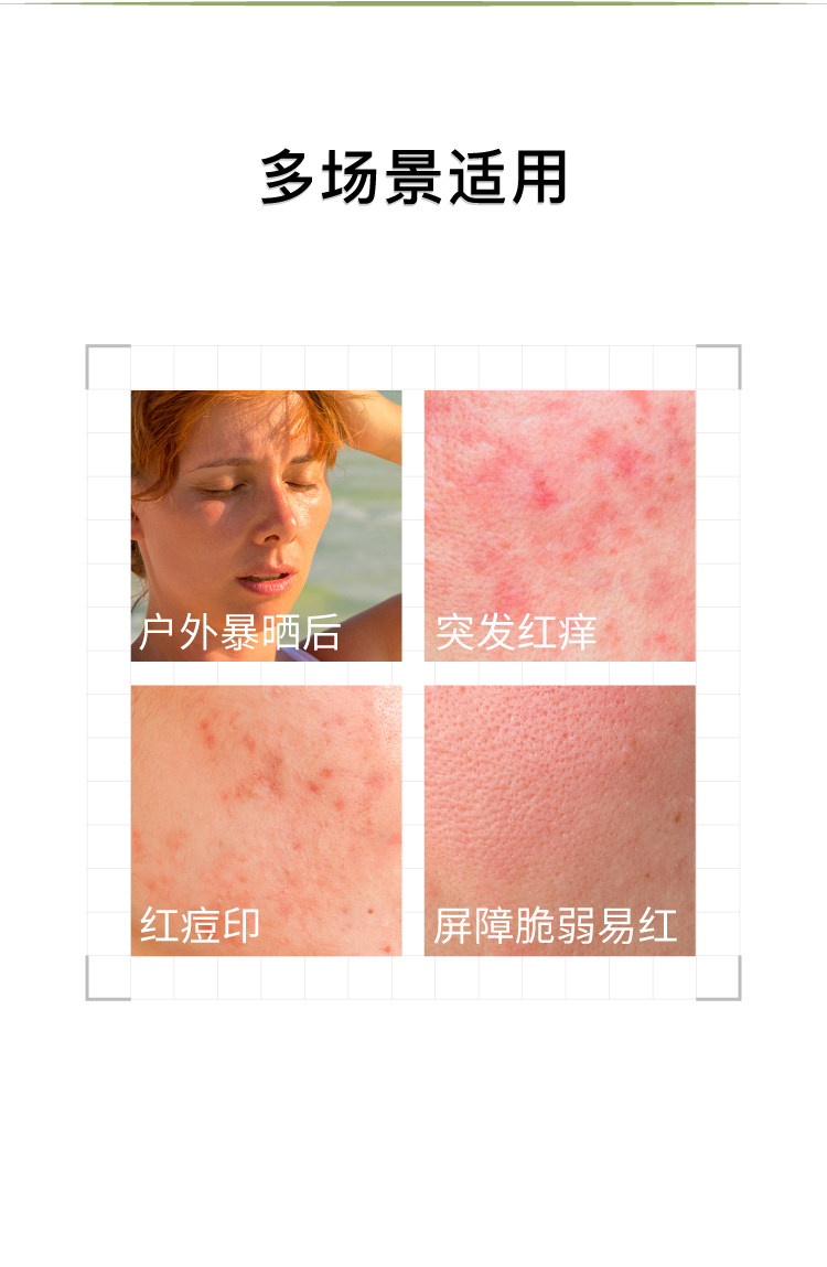 【香港直邮】 John Jeff 油橄榄冻膜80g 敏感肌急救睡眠面膜 |5%油橄榄精粹 |褪红止痒即刻降温 |清爽啫喱质地 |免洗型修护