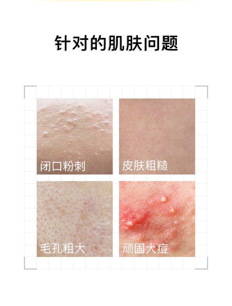 【香港直郵】 John Jeff 甘醇酸棉片55片 5%複合酸配方 去角質+淡痘印 油痘肌濕敷神器