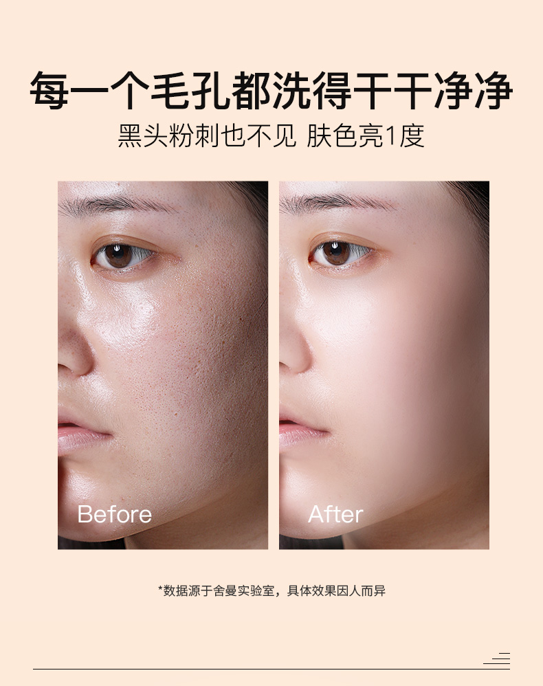 Sherman Tẩy Tế Bào Chết Cho Nữ Làm Sạch Sâu Lỗ Chân Lông Kem Mát Xa Mặt Trị Mụn Đầu Đen Nhẹ Nhàng Tẩy Tế Bào Chết Cho Nam Sinh Viên tẩy tế bào chết cho da nhạy cảm